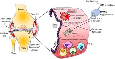 Synovial Macrophages in Osteoarthritis: The Key to Understanding Pathogenesis?